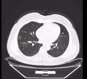 透视生命，洞悉健康：详解医学影像处理软件的革新应用