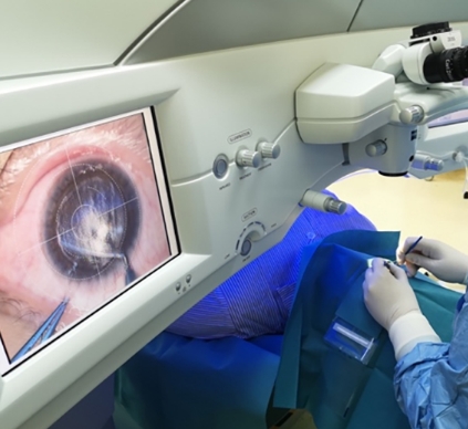 科技守护视力：探索最新全飞秒激光近视矫正技术的突破