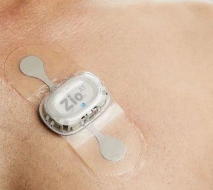 移动健康监测站：可穿戴心电图设备如何实现持续健康管理