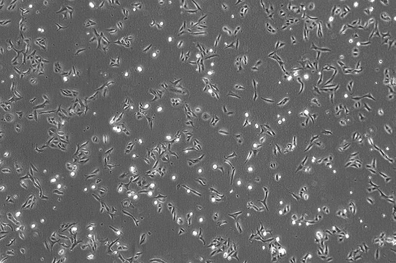 (U2OS&nbsp;细胞)放大倍率：40×，相差